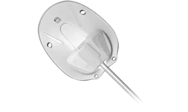 Ahmed Glaucoma Valve