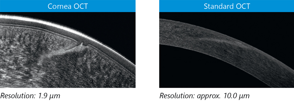 Resolution comparison between Cornea OCT and Standard OCT